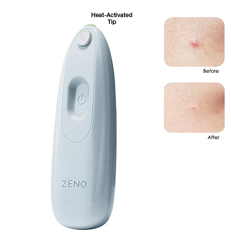 Avon Zeno® for Clearskin® Professional