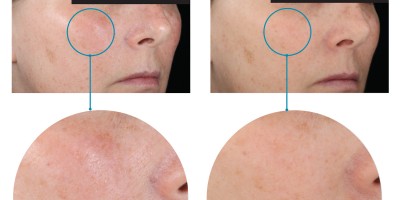 SkinCeuticals Metacell Renewal B3