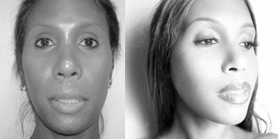 Plastic surgeon Dr. Jeffrey Spiegel explains aesthetic procedures